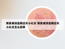 银屑病消退期还长小红点 银屑病消退期还长小红点怎么回事