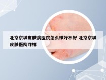 北京京城皮肤病医院怎么样好不好 北京京城皮肤医院咋样