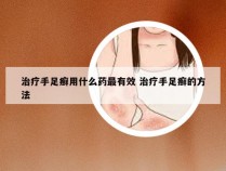 治疗手足癣用什么药最有效 治疗手足癣的方法