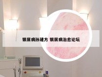 银屑病孙建方 银屑病治愈论坛