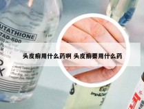 头皮癣用什么药啊 头皮癣要用什么药