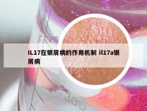 IL17在银屑病的作用机制 il17a银屑病