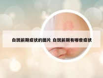 白斑前期症状的图片 白斑前期有哪些症状