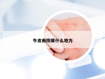 牛皮癣按摩什么地方