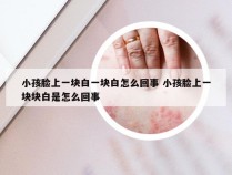 小孩脸上一块白一块白怎么回事 小孩脸上一块块白是怎么回事