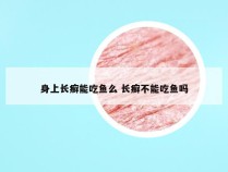 身上长癣能吃鱼么 长癣不能吃鱼吗