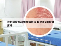 注射白介素23银屑病用法 白介素2治疗银屑吗