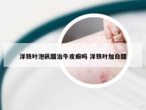 洋铁叶泡矾醋治牛皮癣吗 洋铁叶加白醋