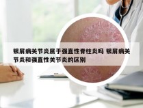 银屑病关节炎属于强直性脊柱炎吗 银屑病关节炎和强直性关节炎的区别