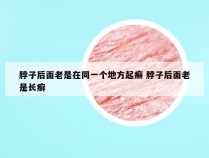 脖子后面老是在同一个地方起癣 脖子后面老是长癣