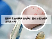 昆仙胶囊治疗银屑病关节炎 昆仙胶囊治疗风湿效果如何