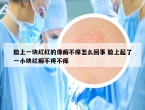 脸上一块红红的像癣不痒怎么回事 脸上起了一小块红癣不疼不痒