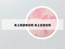 身上局部有白斑 身上出现白斑