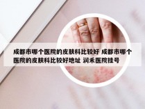 成都市哪个医院的皮肤科比较好 成都市哪个医院的皮肤科比较好地址 润禾医院挂号