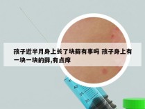 孩子近半月身上长了块藓有事吗 孩子身上有一块一块的藓,有点痒