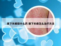 掖下长癣搽什么药 腋下长癣怎么治疗方法