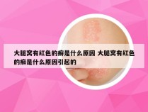 大腿窝有红色的癣是什么原因 大腿窝有红色的癣是什么原因引起的