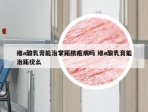 维a酸乳膏能治掌跖脓疱病吗 维a酸乳膏能治跖疣么