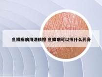 鱼鳞癣病用酒精擦 鱼鳞病可以擦什么药膏