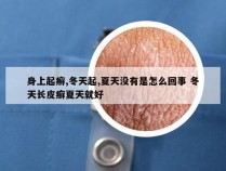 身上起癣,冬天起,夏天没有是怎么回事 冬天长皮癣夏天就好