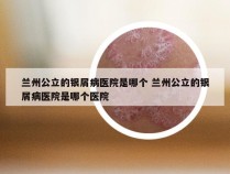 兰州公立的银屑病医院是哪个 兰州公立的银屑病医院是哪个医院