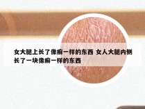 女大腿上长了像癣一样的东西 女人大腿内侧长了一块像癣一样的东西