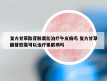 复方甘草酸苷胶囊能治疗牛皮癣吗 复方甘草酸苷胶囊可以治疗银屑病吗