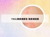 730人银屑病报告 银屑病结果