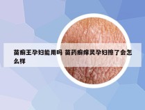 苗癣王孕妇能用吗 苗药癣痒灵孕妇擦了会怎么样