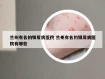 兰州有名的银屑病医院 兰州有名的银屑病医院有哪些