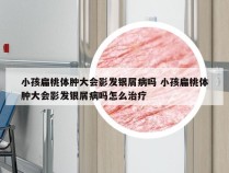 小孩扁桃体肿大会影发银屑病吗 小孩扁桃体肿大会影发银屑病吗怎么治疗