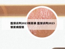 医保谈判2023银屑病 医保谈判2023银屑病报销