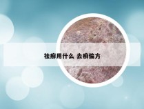 祛癣用什么 去癣偏方