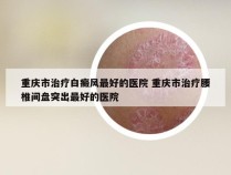 重庆市治疗白癜风最好的医院 重庆市治疗腰椎间盘突出最好的医院