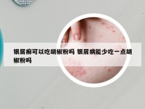 银屑癣可以吃胡椒粉吗 银屑病能少吃一点胡椒粉吗