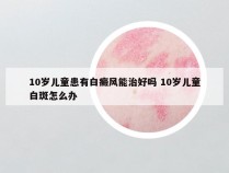 10岁儿童患有白癜风能治好吗 10岁儿童白斑怎么办