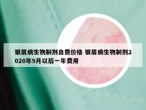 银屑病生物制剂自费价格 银屑病生物制剂2020年9月以后一年费用