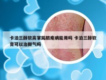 卡泊三醇软高掌跖脓疱病能用吗 卡泊三醇软膏可以治脚气吗