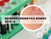 越洋狼毒癣痒宁狼毒癣痒宁乳膏 狼毒癣痒灵多少钱一盒