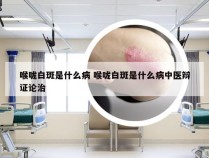 喉咙白斑是什么病 喉咙白斑是什么病中医辩证论治