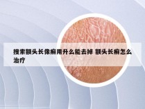 搜索额头长像癣用升么能去掉 额头长癣怎么治疗