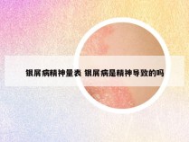 银屑病精神量表 银屑病是精神导致的吗