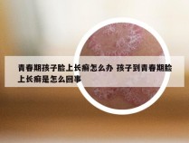 青春期孩子脸上长癣怎么办 孩子到青春期脸上长癣是怎么回事