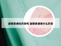 副银屑病吃药贵吗 副银屑病用什么药膏