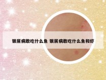 银屑病敢吃什么鱼 银屑病敢吃什么鱼和虾