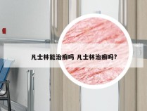 凡士林能治癣吗 凡士林治癣吗?