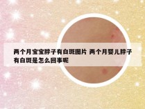 两个月宝宝脖子有白斑图片 两个月婴儿脖子有白斑是怎么回事呢