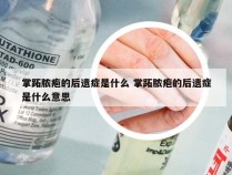 掌跖脓疱的后遗症是什么 掌跖脓疱的后遗症是什么意思