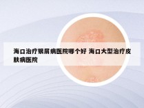 海口治疗银屑病医院哪个好 海口大型治疗皮肤病医院