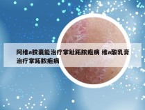 阿维a胶囊能治疗掌趾跖脓疱病 维a酸乳膏治疗掌跖脓疱病